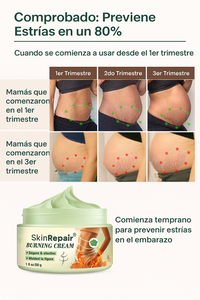 Skin Repair Antiestrias